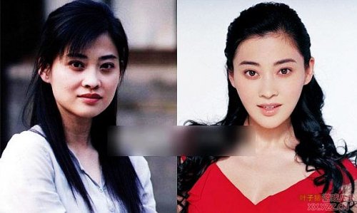 娱乐圈女明星大饼脸惊变锥子
